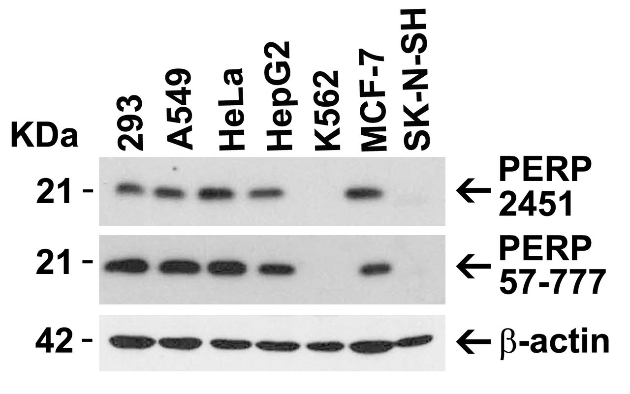 Figure 1 Independent Antibody Validation (IAV) via Protein Expression Profile in Human Cell Lines
Loading: 15 &#956;g of lysates per lane.
Antibodies: PERP 2451 (1 &#956;g/mL) , PERP, 57-777 (2 &#956;g/mL) , beta-actin 3779 (1 &#956;g/mL) and GAPDH (0.02 &#956;g/mL) , 1h incubation at RT in 5% NFDM/TBST.
Secondary: Goat anti-rabbit IgG HRP conjugate at 1:10000 dilution.