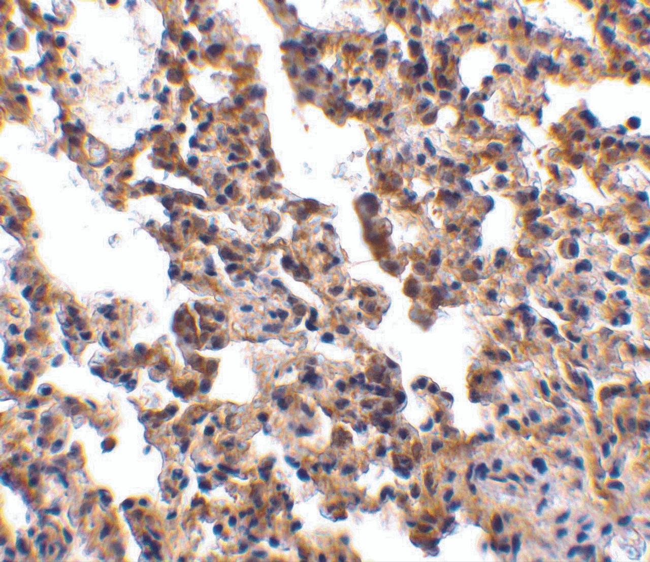 Immunohistochemistry of IL-21 receptor in rat lung with IL-21 receptor antibody at 10 ug/mL.