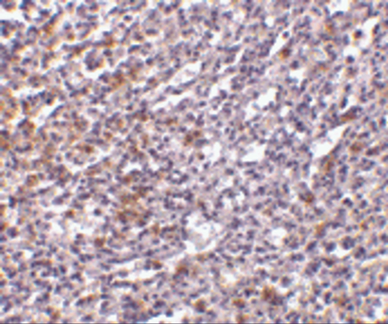 Immunohistochemistry of TCCR in human spleen tissue with TCCR antibody at 10 ug/mL.