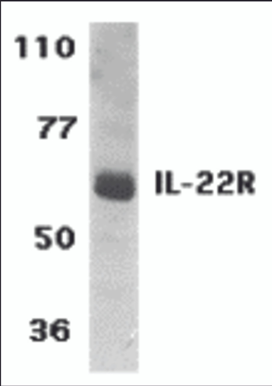 Western blot analysis of IL-22 Receptor expression in human HepG2 cell lysate with IL-22 Receptor antibody at 1 &#956;g/ml.