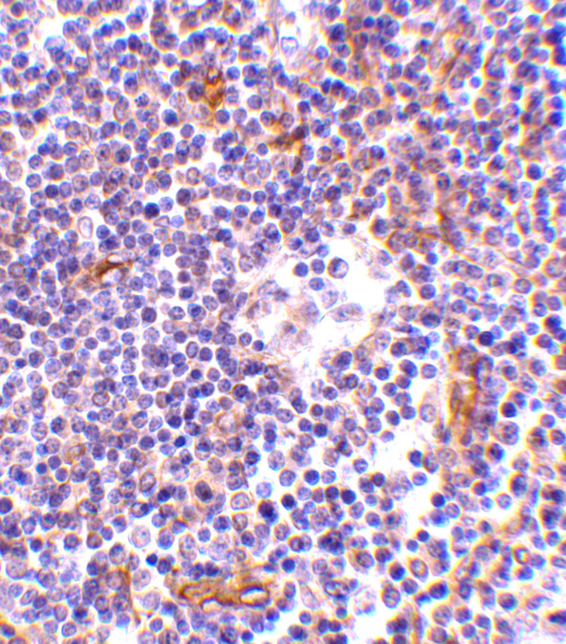 Immunohistochemistry of KappaB ras in human lymph node tissue with KappaB ras antibody at 1 ug/mL.