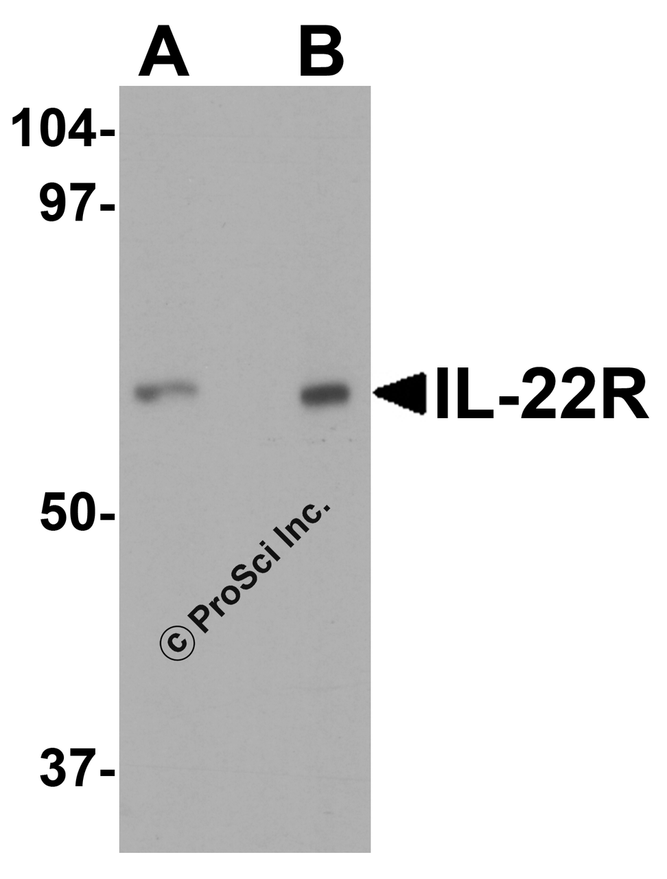 Western blot analysis of IL-22 receptor expression in human HepG2 cell lysate with IL-22 receptor antibody at (A) 0.5 and (B) 1 &#956;g/ml.