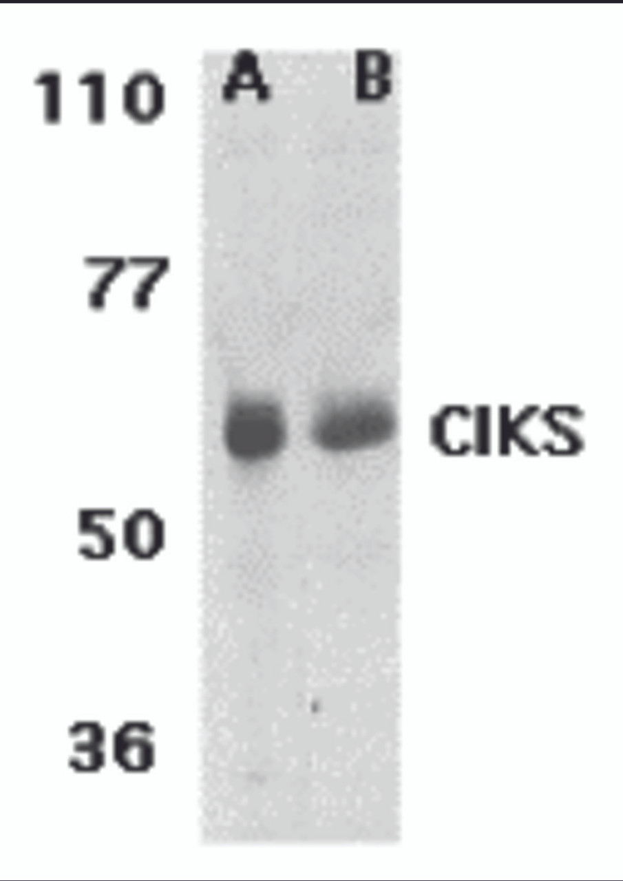 Western blot analysis of CIKS expression in human lung (lane A) and placenta (lane B) tissue lysates with CIKS antibody at 1 &#956;g/ml.