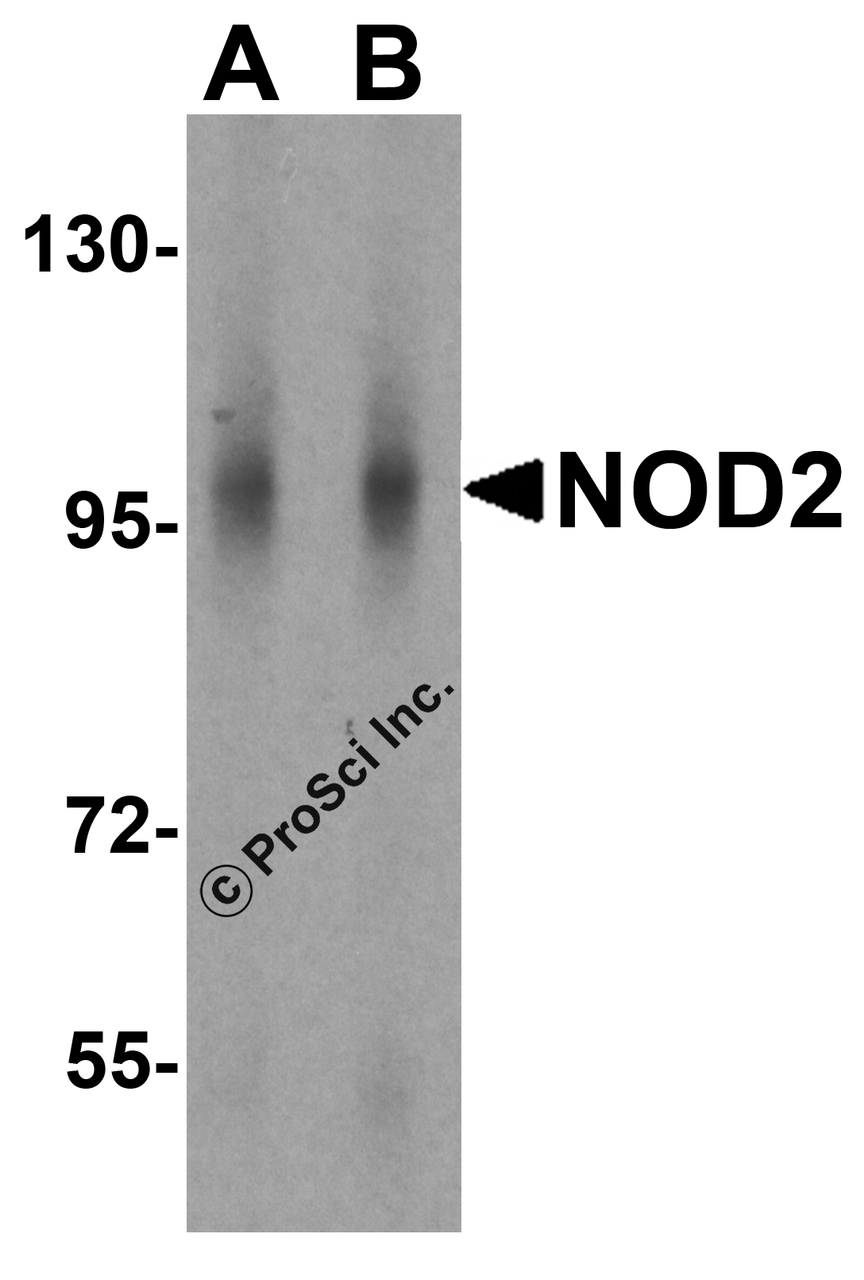 Western blot analysis of NOD2 in human lymph node tissue lysate with NOD2 antibody at (A) 1 and (B) 2 &#956;g/mL.