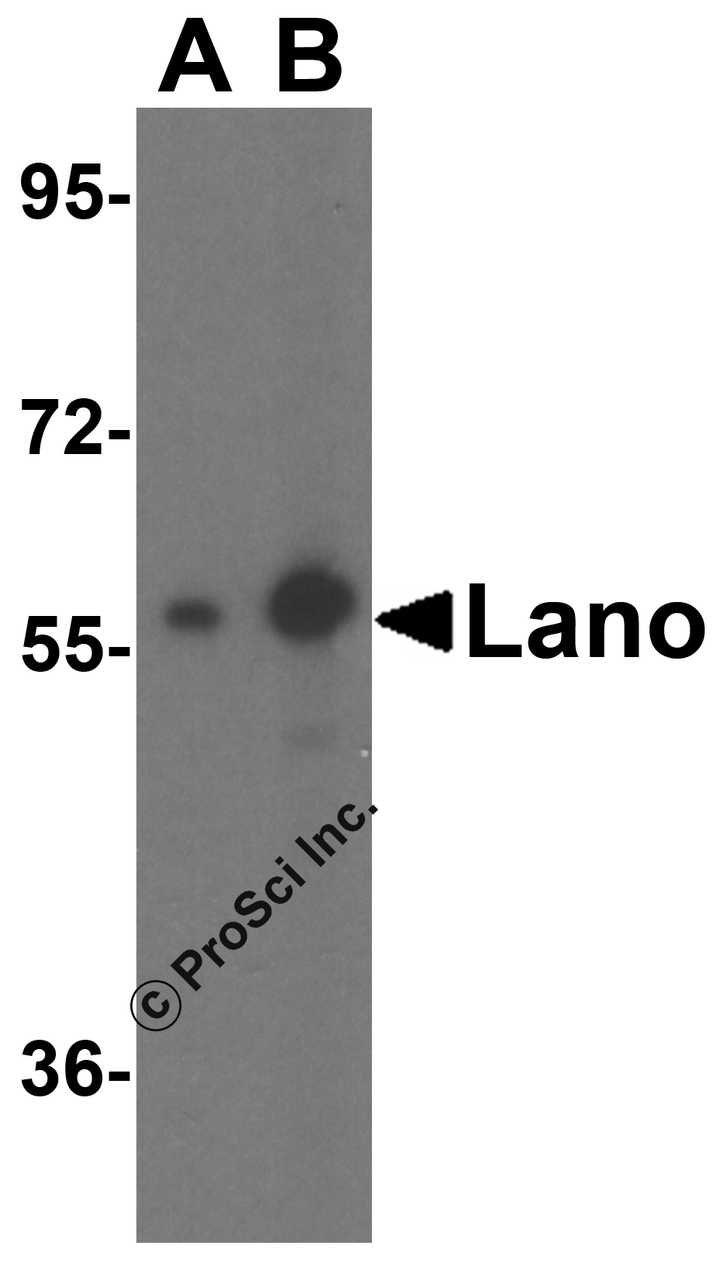 Western blot analysis of Lano expression in A431 cell lysate with Lano antibody at (A) 1 and (B) 2 &#956;g/ml.