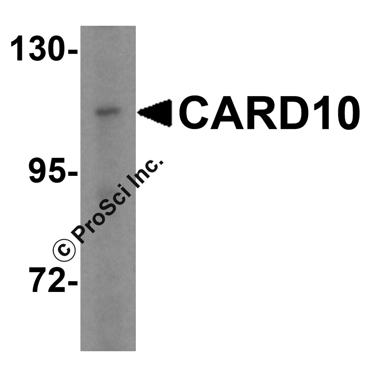 Western blot analysis of CARD10 in A-20 cell lysate with CARD10 antibody at 5 &#956;g/mL.