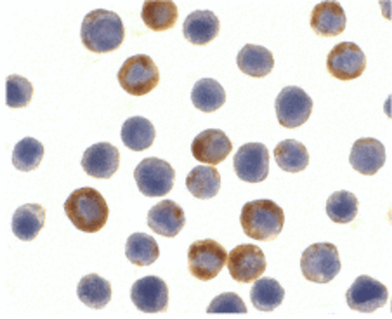Immunocytochemistry of ILP-2 in HepG2 cells with ILP-2 antibody at 10 ug/mL.