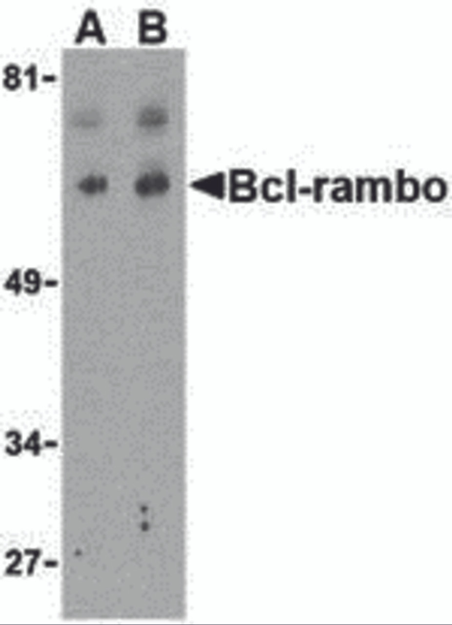 Western blot analysis of Bcl-rambo in K562 cell lysate with Bcl-rambo antibody at (A) 2 and (B) 4 &#956;g/mL.