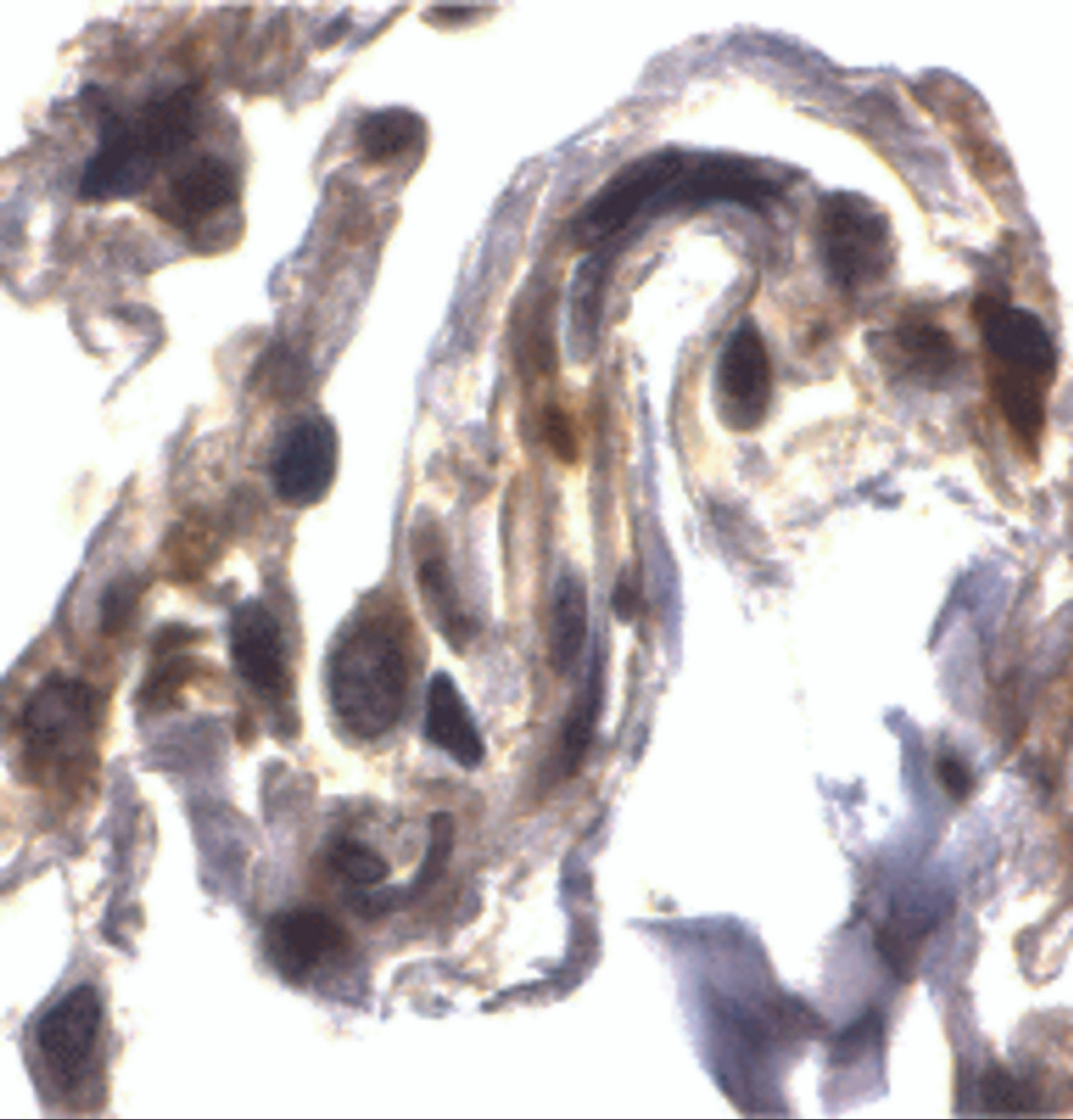 Immunohistochemistry of ARTS in human lung tissue with ARTS antibody at 2 ug/mL.