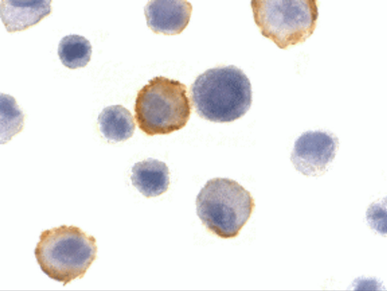 Immunocytochemistry of Bmf in HeLa cells with Bmf antibody at 10 ug/mL.