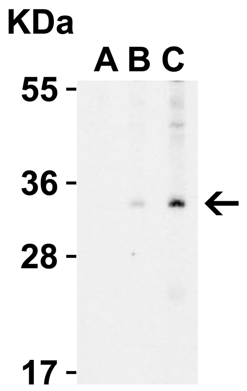 Figure 2 Western Blot Validation in Human A431 Cell Lysate with the presence (A) or absence (B and C) of blocking peptide
Loading: 15 ug of lysates per lane.
Antibodies: EndoG 3035 (A: 0.5 ug/mL, B: 0.5 ug/mL, C: 1 ug/mL) , 1h incubation at RT in 5% NFDM/TBST.
Secondary: Goat anti-rabbit IgG HRP conjugate at 1:10000 dilution.