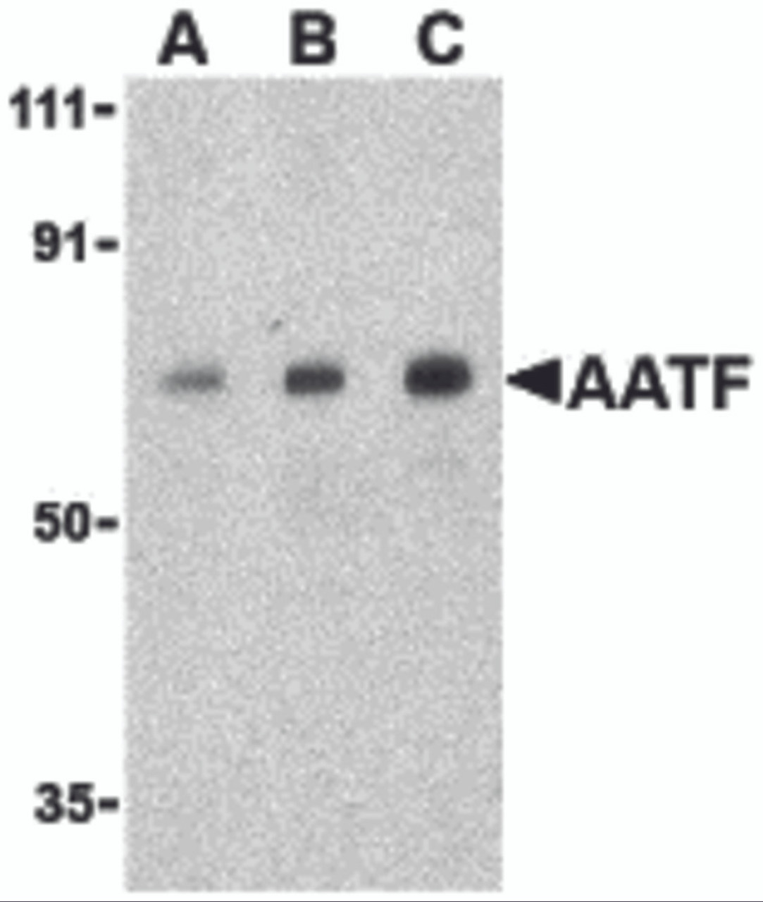 Western blot analysis of AATF in human small intestine cell lysate with AATF antibody at (A) 0.5, (B) 1 and (C) 2 &#956;g/mL.