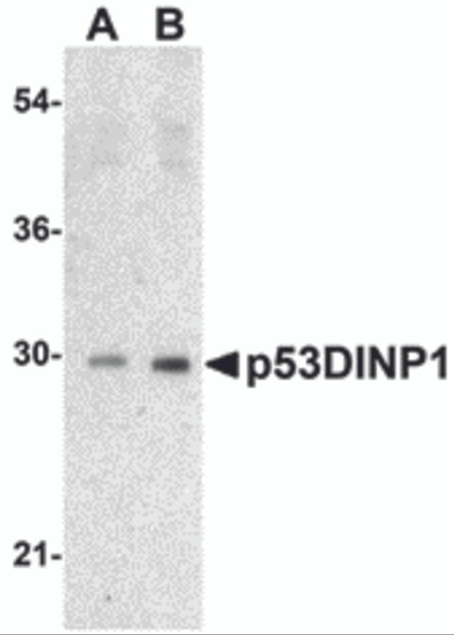 Western blot analysis of p53DINP1 expression in human lung tissue lysate with p53DINP1 antibody at (A) 0.5 and (B) 1 &#956;g/mL.