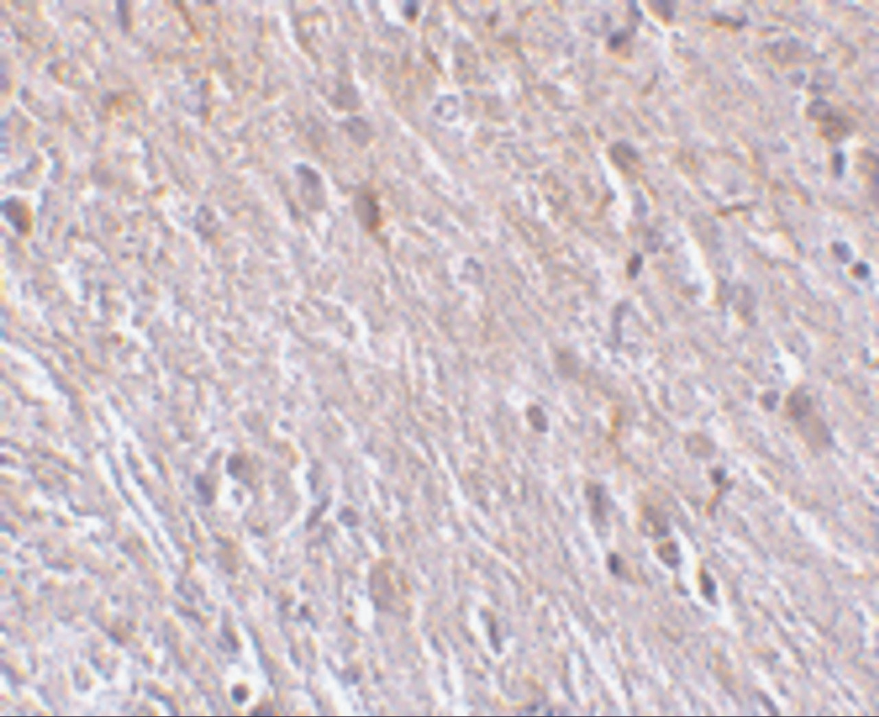 Immunohistochemistry of TTC5 in mouse brain tissue with TTC5 antibody at 10 ug/mL.