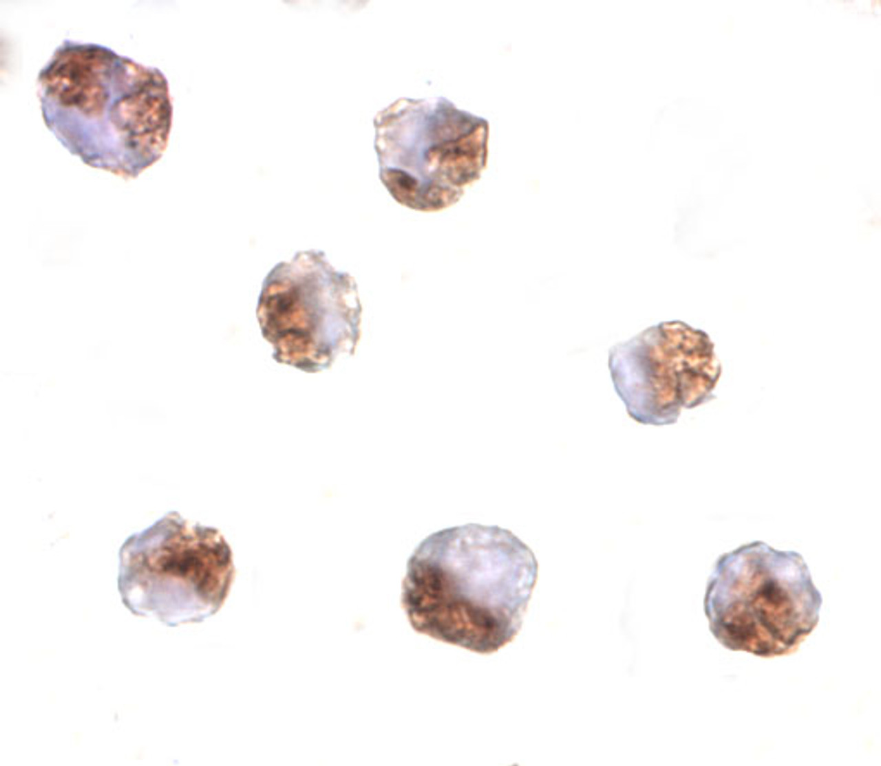 Immunocytochemistry of PAK6 in Raji cells with PAK6 antibody at 10 ug/mL.