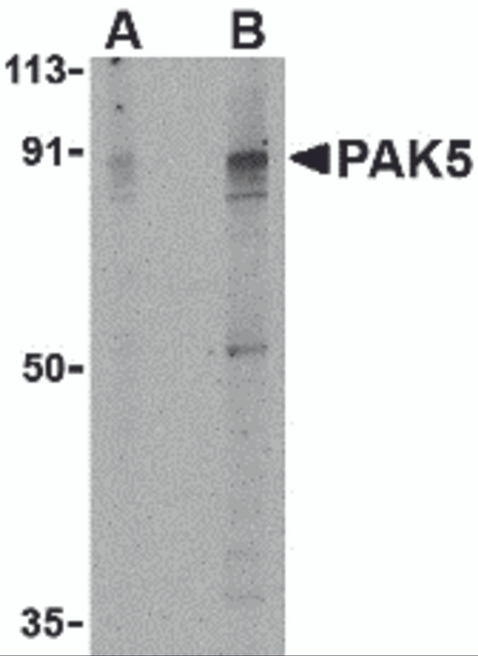 Western blot analysis of PAK5 in T24 lysate with PAK5 antibody at (A) 2 and (B) 4 &#956;g/mL.