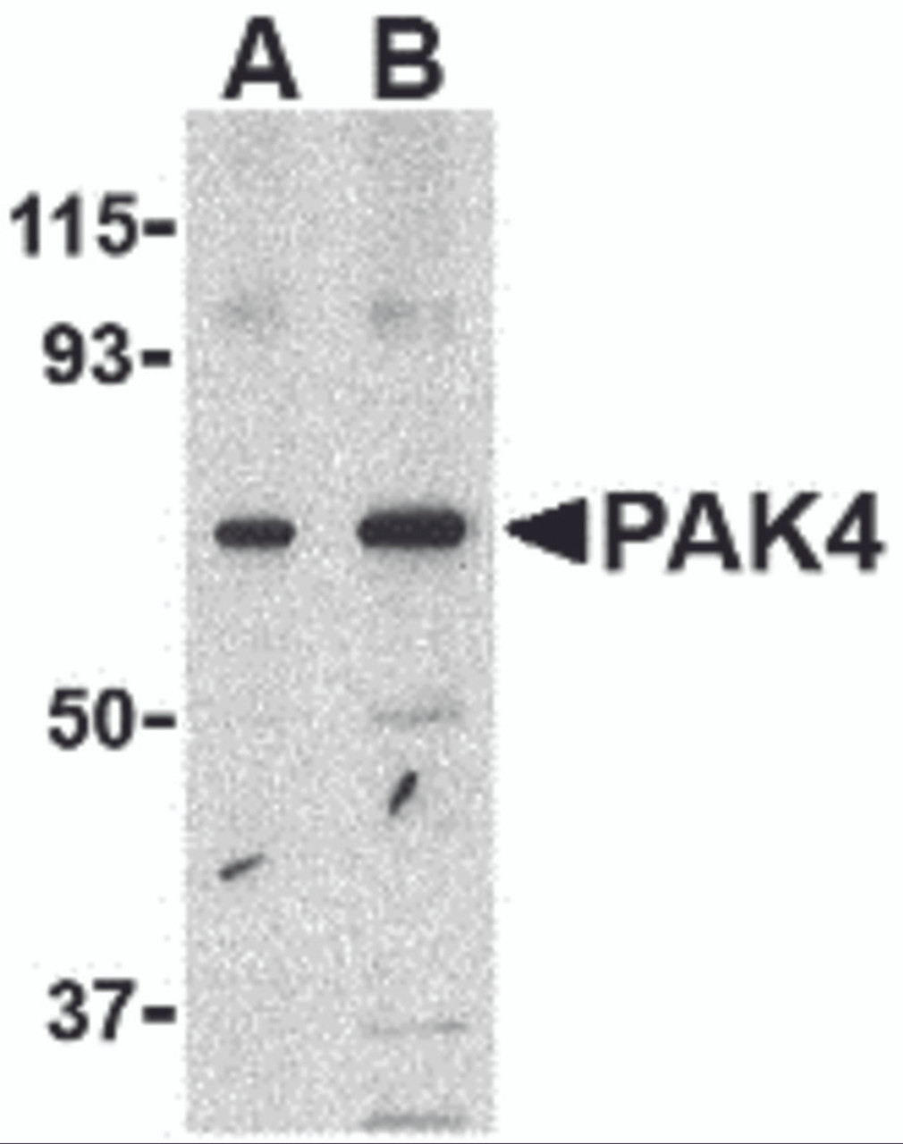 Western blot analysis of PAK4 in SW480 lysate with PAK4 antibody at (A) 1 and (B) 2 &#956;g/mL.