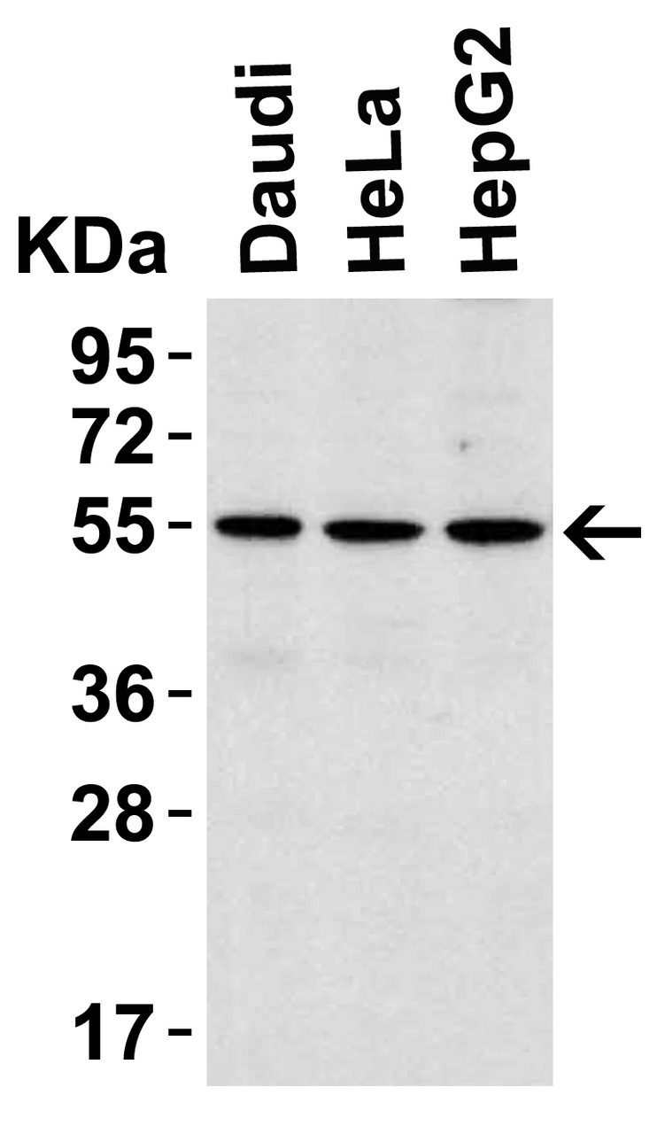 Figure 1 Western Blot Validation in Human Cell Lines
Loading: 15 &#956;g/ of lysates per lane.
Antibodies: IRAK4 3125 (1 &#956;g/mL) , 1h incubation at RT in 5% NFDM/TBST.
Secondary: Goat anti-rabbit IgG HRP conjugate at 1:10000 dilution.