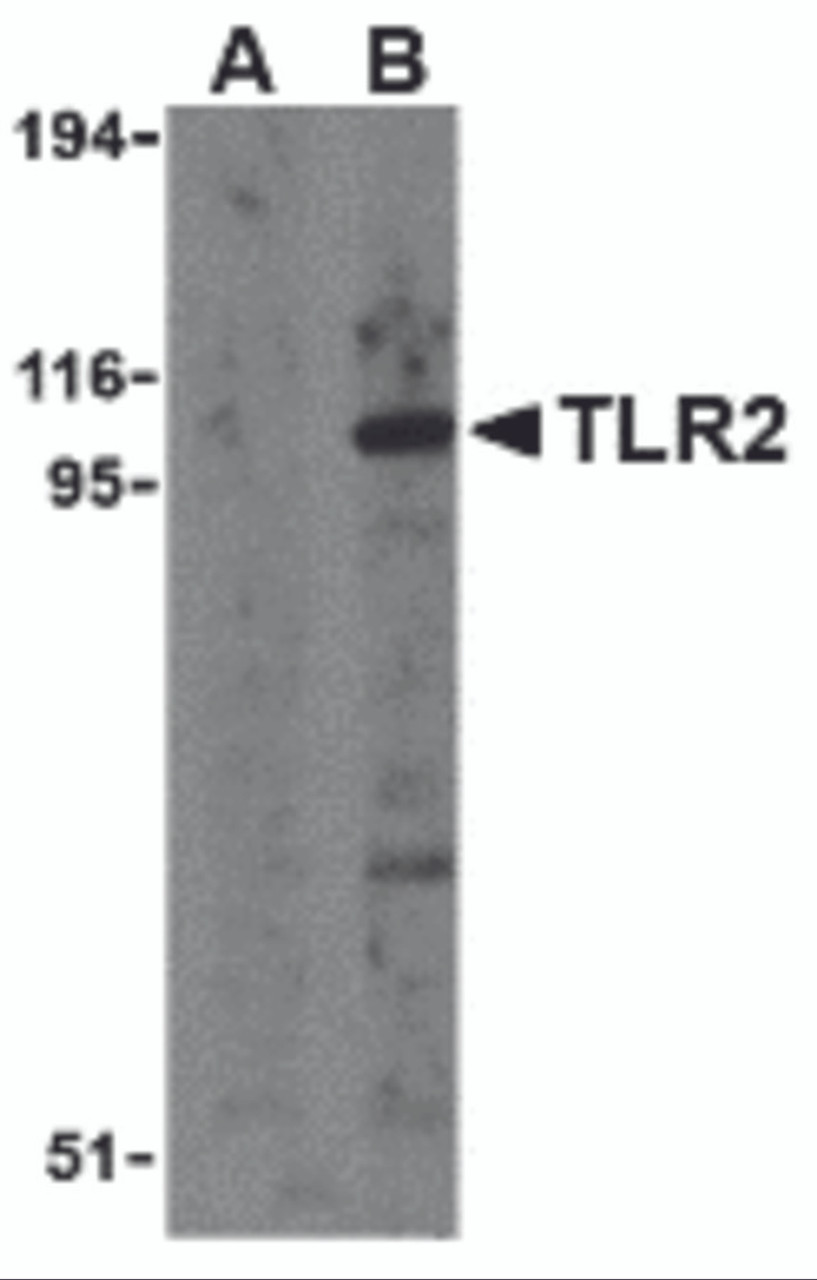 Western blot analysis of TLR2 in A20 cell lysates with TLR2 antibody at 1 &#956;g/mL in the presence (A) and absence (B) of its blocking peptide.