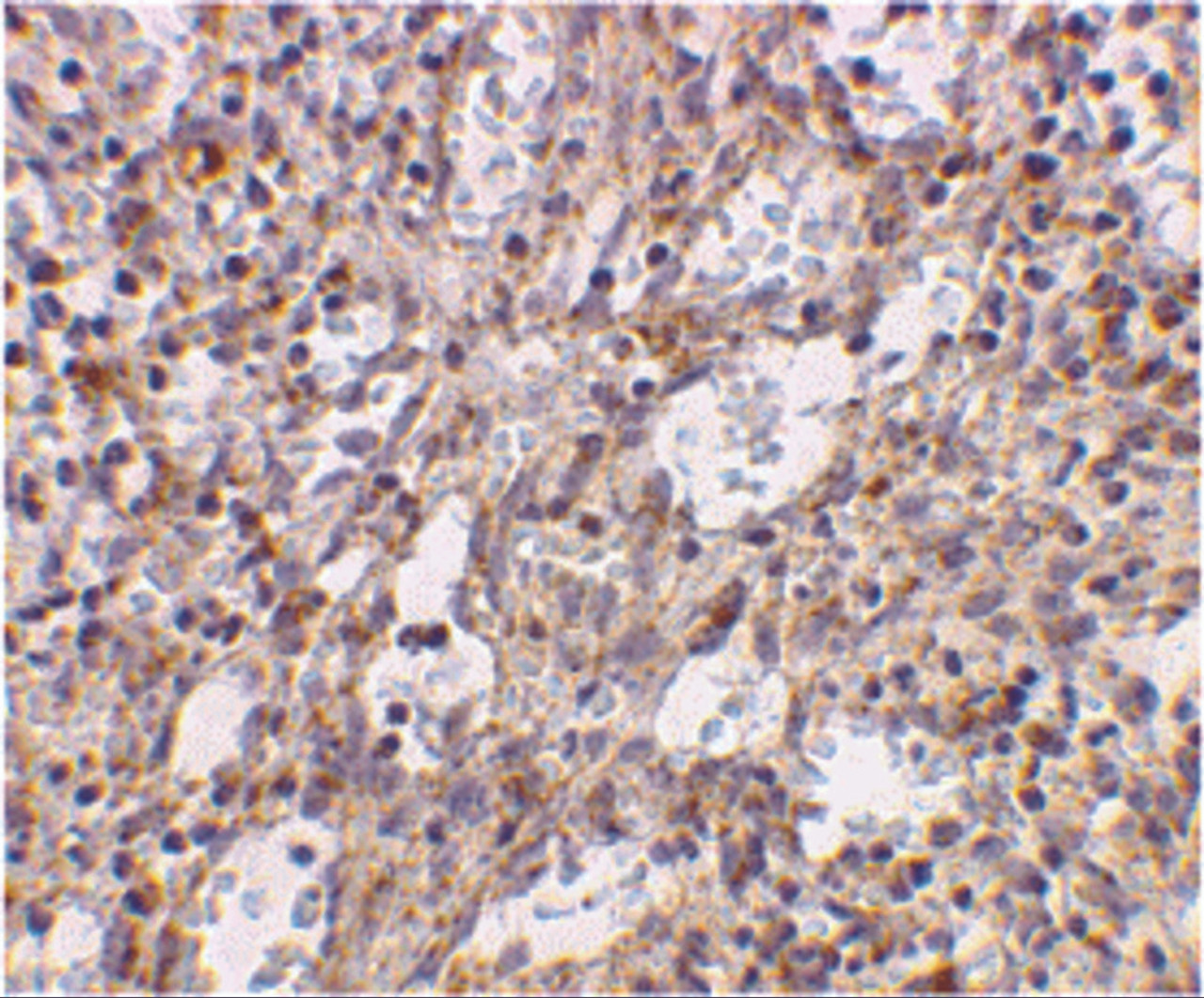 Immunohistochemical staining of human spleen cells using TLR2 antibody at 2 ug/mL.