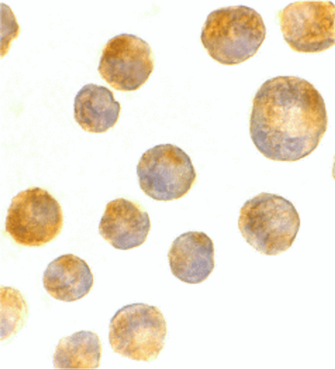 Immunocytochemistry of TLR4 in K562 cells with TLR4 antibody at 2 ug/mL.