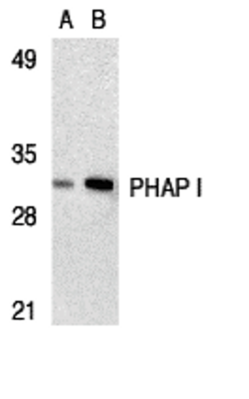 Figure 1 Western Blot Validation in Human Raji Cell Lysate
Loading: 15 &#956;g of lysates per lane.
Antibodies: PHAP I 3145 (A: 2 &#956;g/mL, B: 4 &#956;g/mL) , 1h incubation at RT in 5% NFDM/TBST.
Secondary: Goat anti-rabbit IgG HRP conjugate at 1:10000 dilution.