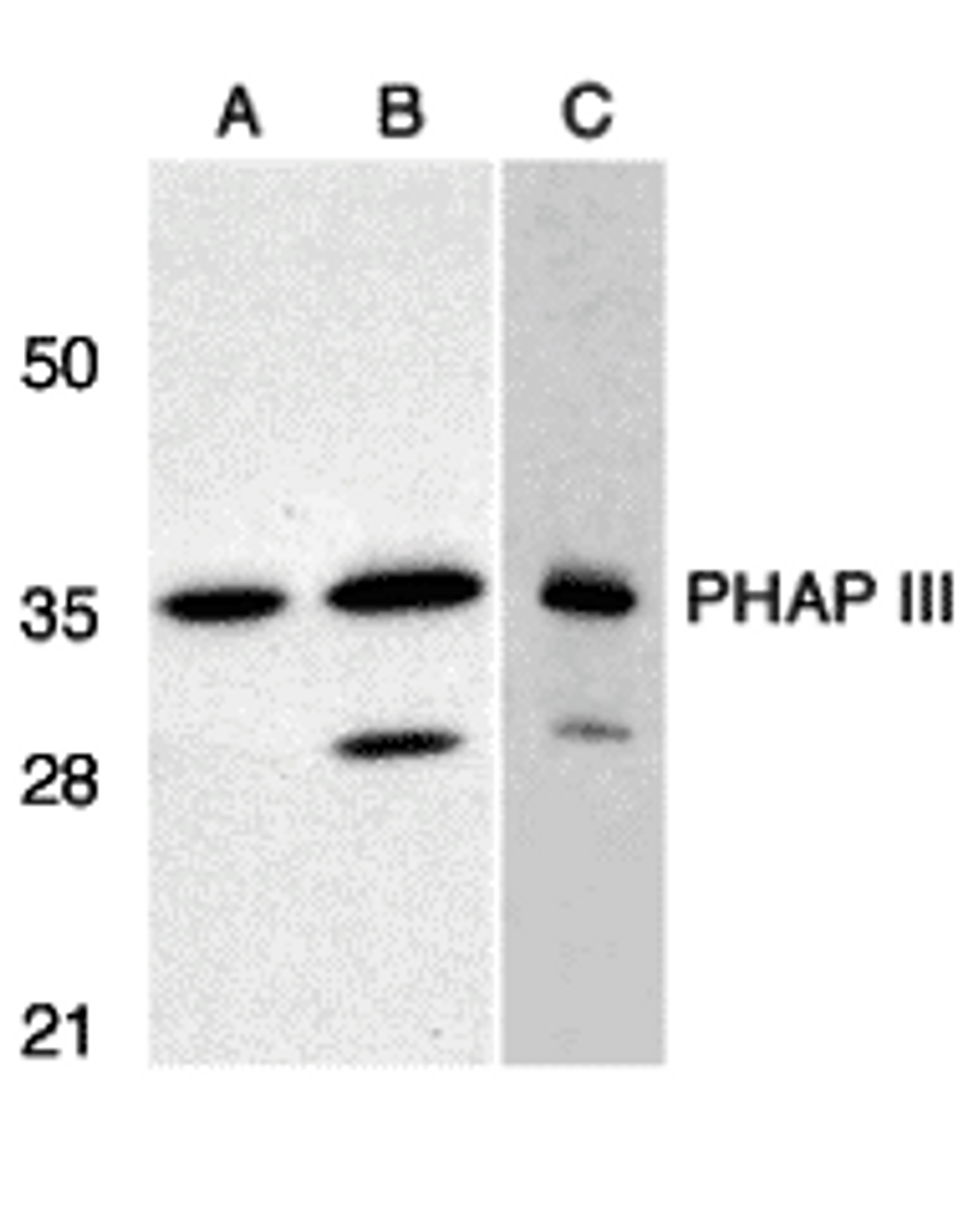 Western blot analysis of PHAP III expression in human A549 (A) and HepG2 (B) cells, and rat testis (C) with PHAP antibody III at 1 &#956;g/mL.