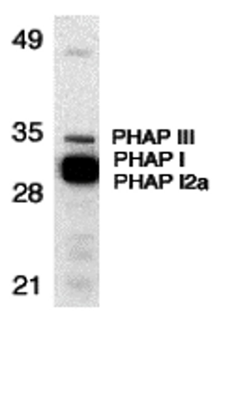 Western blot analysis of PHAP expression in human Raji cell lysate with PHAP antibody at 1 &#956;g/mL. The wide and strong band below PHAP III is a doublelet composed of PHAP I (upper) and PHAP I2a (lower) .