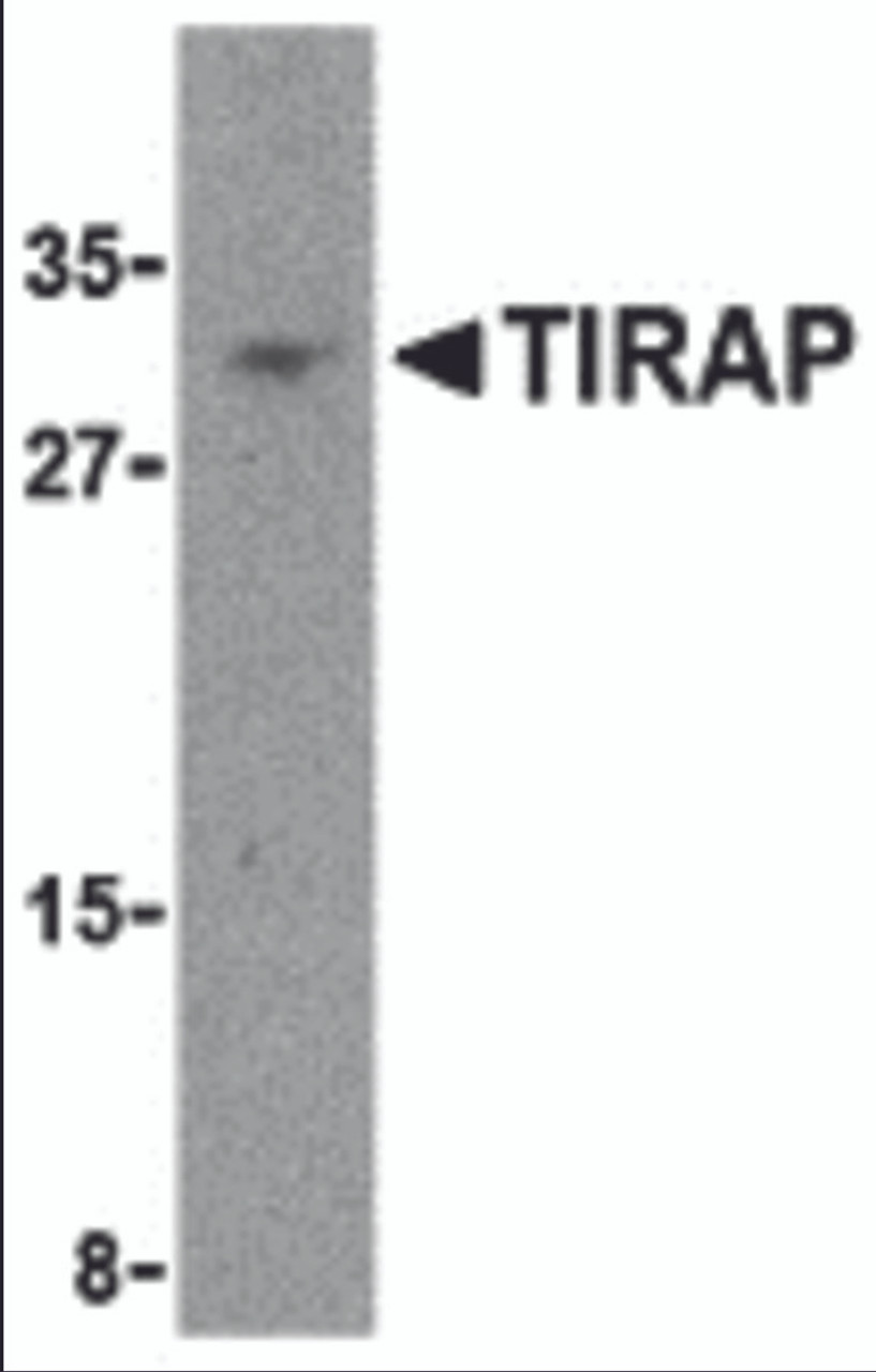 Western blot analysis of TIRAP in MCF-7 cell lysate with TIRAP antibody at 4 &#956;g/mL.