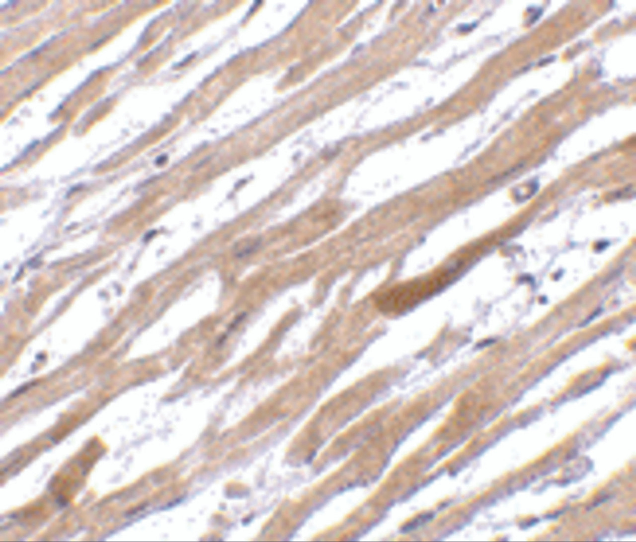 Immunohistochemistry of TIRAP in human heart tissue with TIRAP antibody at 20 ug/mL.