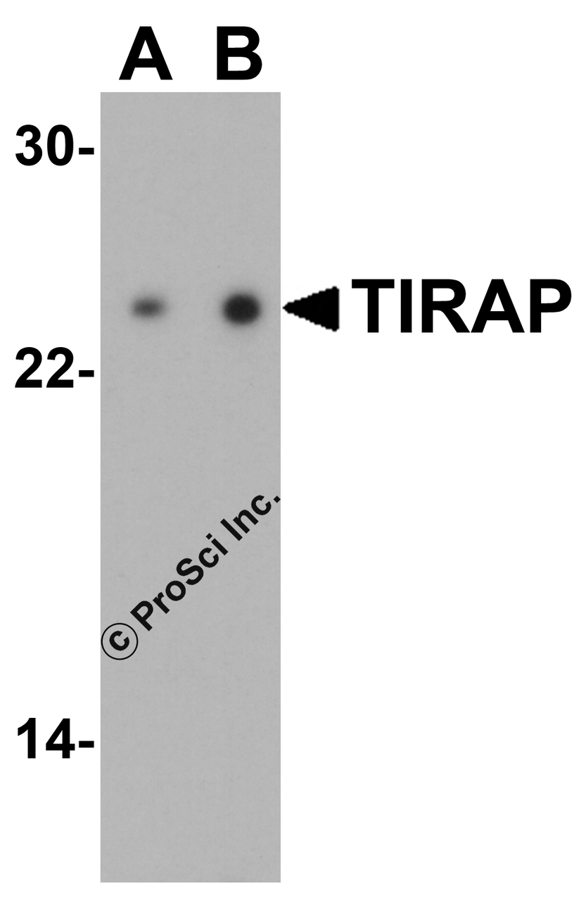 Western blot analysis of TIRAP in human heart tissue lysate with TIRAP antibody at (A) 1 and (B) 2 &#956;g/mL.
