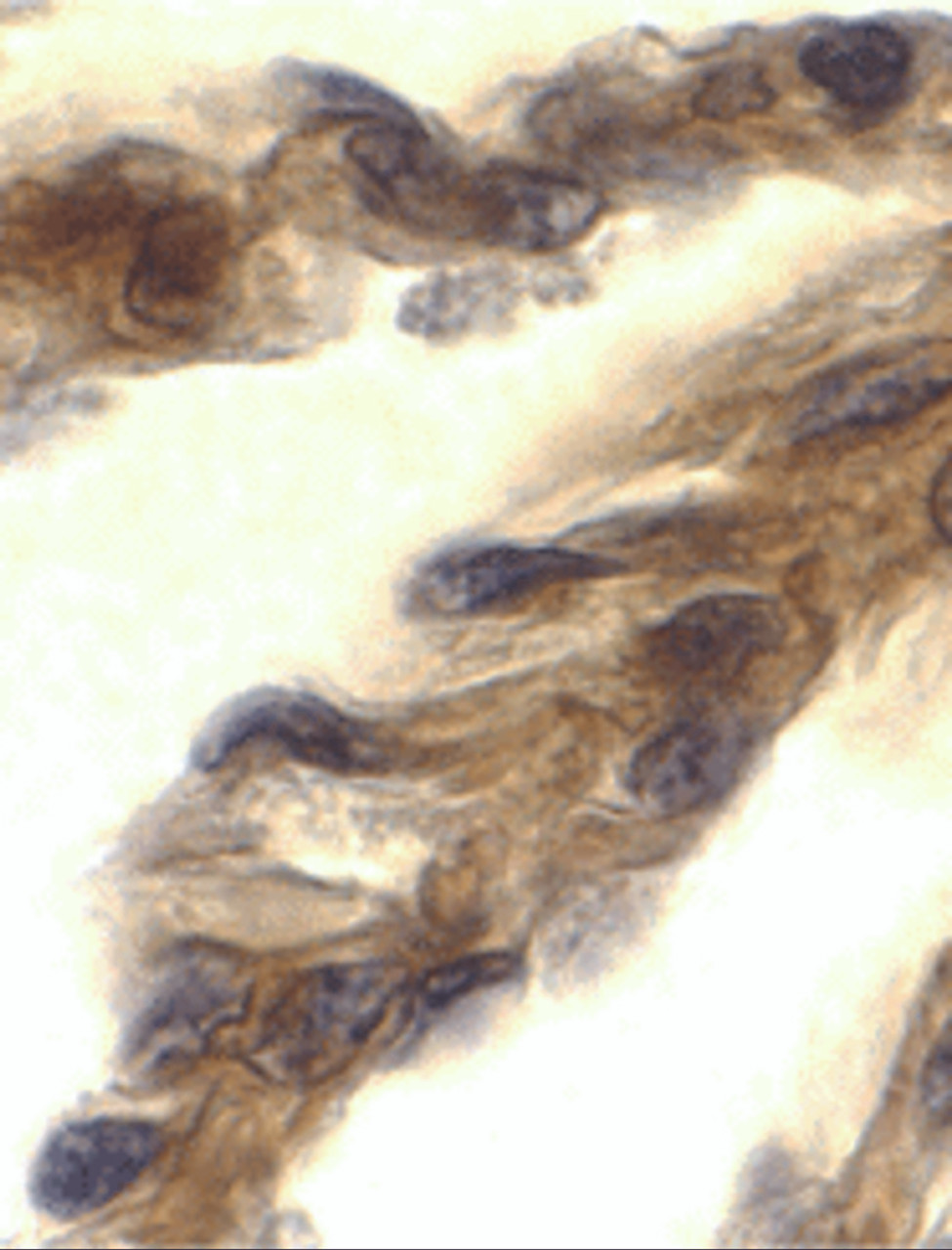 Immunohistochemistry of TRIF in human lung tissue with TRIF antibody at 10 ug/mL.