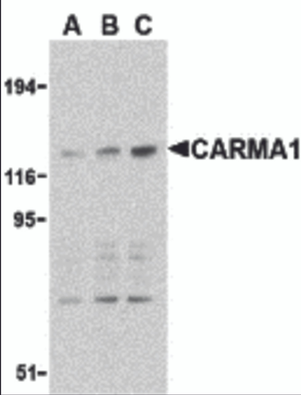 Western blot analysis of CARMA1 expression in mouse thymus cell lysate with CARMA1 antibody at 0.5 (lane A) , 1 (lane B) , and 2 &#956;g/ml (lane C) , respectively.