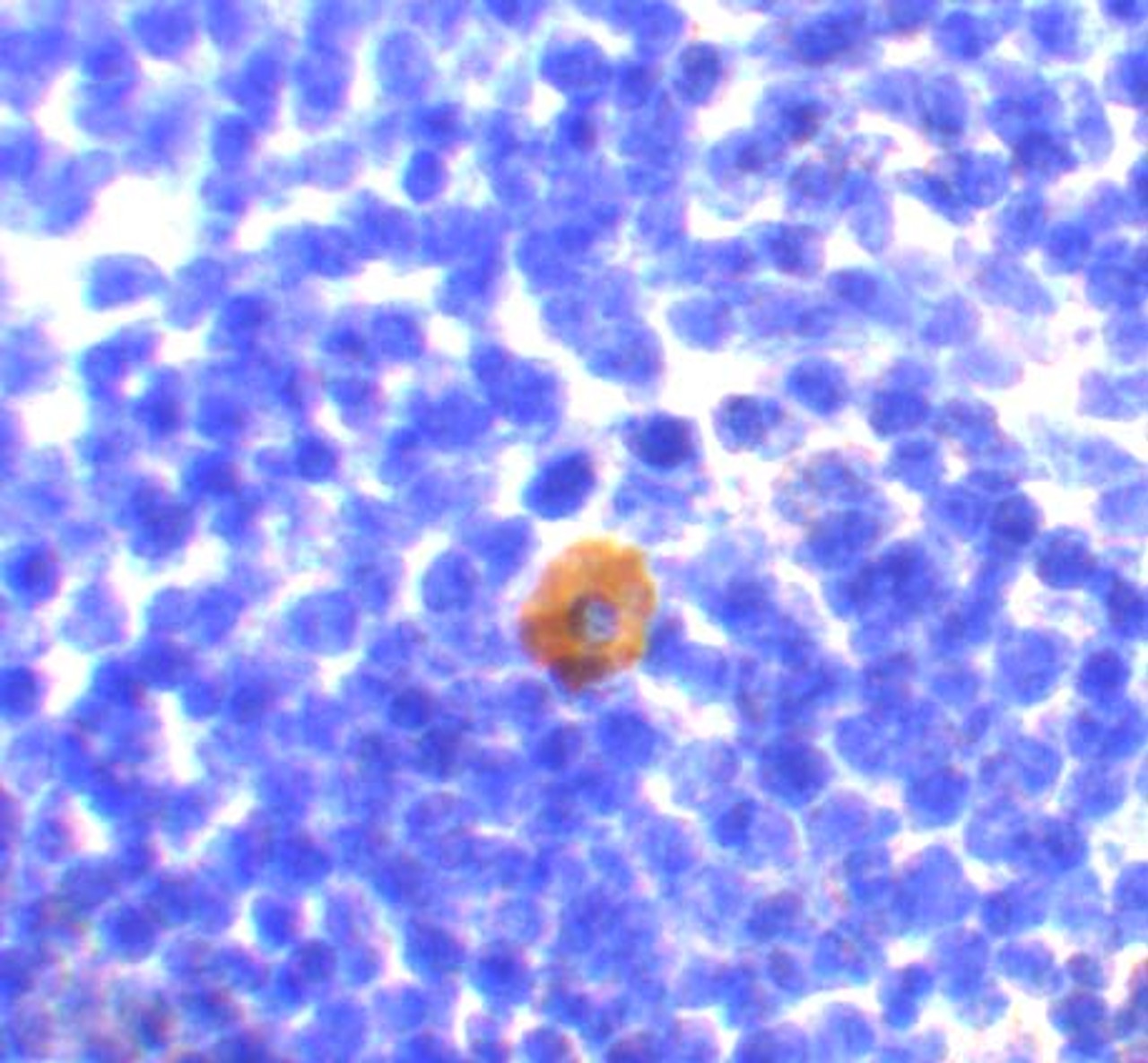 Immunohistochemistry of CARMA1 in mouse thymus with CARMA1 antibody at 10 ug/mL.