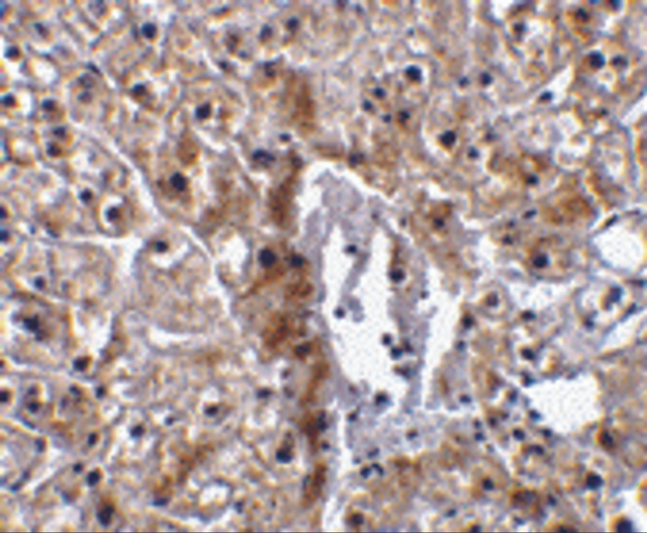 Immunohistochemical staining of human liver tissue using caspase-12 antibody (small) at 10 ug/mL.