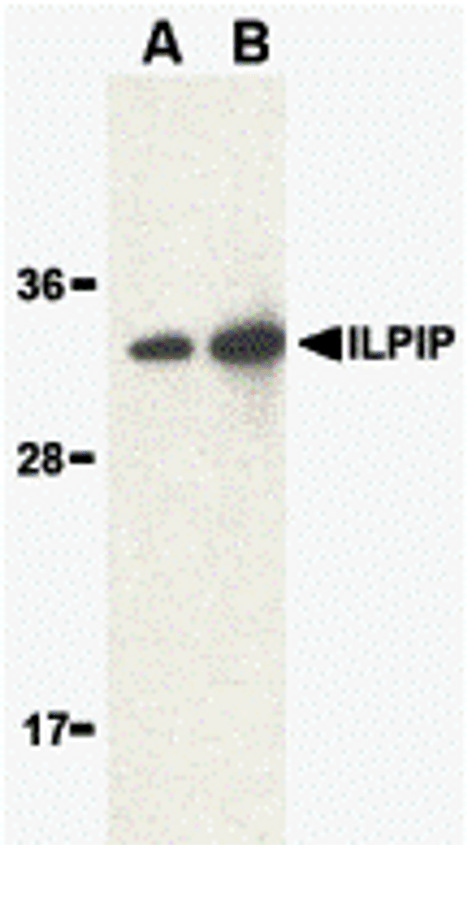 Western blot analysis of ILPIP in human brain lysate with ILPIP antibody at (A) 1 and (B) 2 &#956;g/mL.