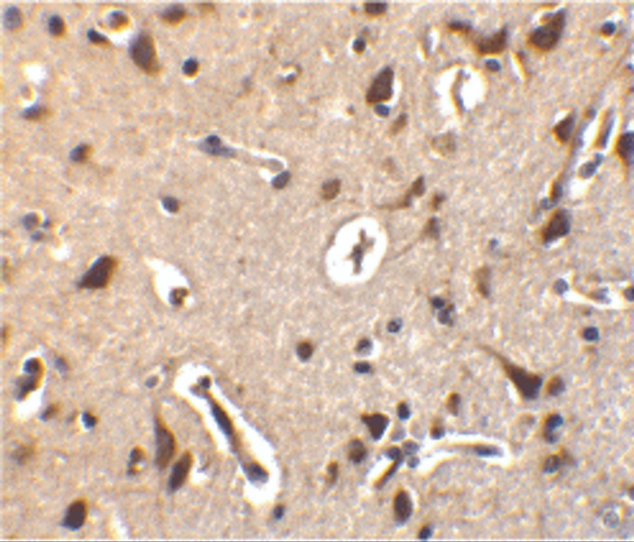 Immunohistochemistry of ILPIP in human brain tissue with ILPIP antibody at 10 ug/mL.