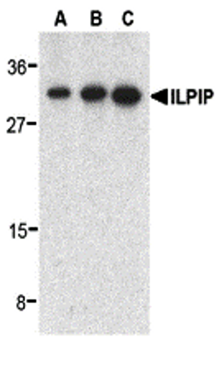 Western blot analysis of ILPIP in human heart lysate with ILPIP antibody at 0.5 (lane A) , 1 (lane B) , and 2 (lane C) &#956;g/mL, respectively.