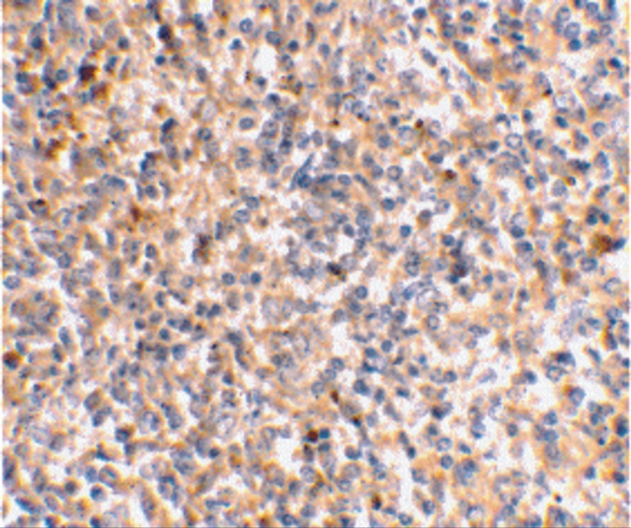 Immunohistochemical staining of human spleen tissue using XAF-1 antibody at 2 ug/mL.