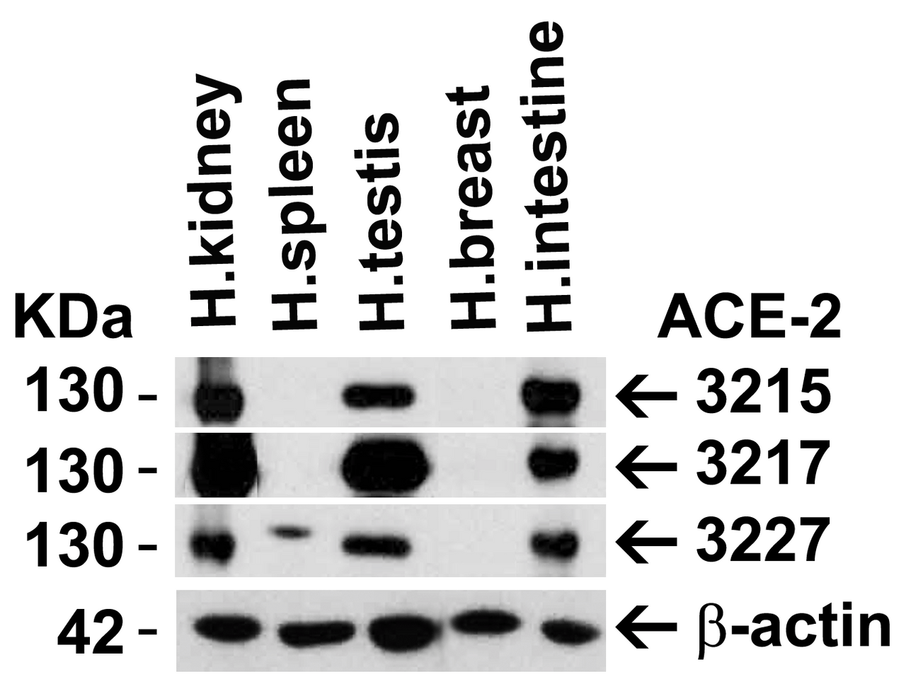 Figure 1 Independent Antibody Validation (IAV) via Protein Expression Profile in Human Tissues
Loading: 15 &#956;g of lysates per lane.
Antibodies: ACE2, 3215 (2 &#956;g/mL) , ACE2, 3217 (2 &#956;g/mL) , ACE2, 3227 (2 &#956;g/mL) and beta-actin 3779 (1 &#956;g/mL) , 1h incubation at RT in 5% NFDM/TBST.
Secondary: Goat anti-rabbit IgG HRP conjugate at 1:10000 dilution.