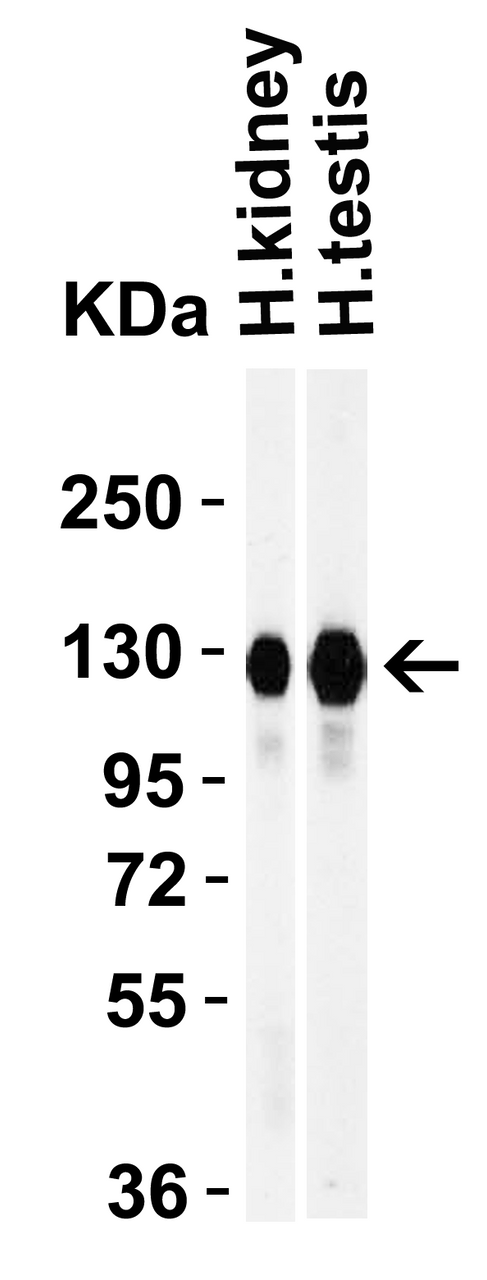 Figure 2 Western Blot Validation in Human Tissues
Loading: 15 ug of lysates per lane.
Antibodies: ACE2, 3227 (1 ug/mL) , 1h incubation at RT in 5% NFDM/TBST.
Secondary: Goat anti-rabbit IgG HRP conjugate at 1:10000 dilution.