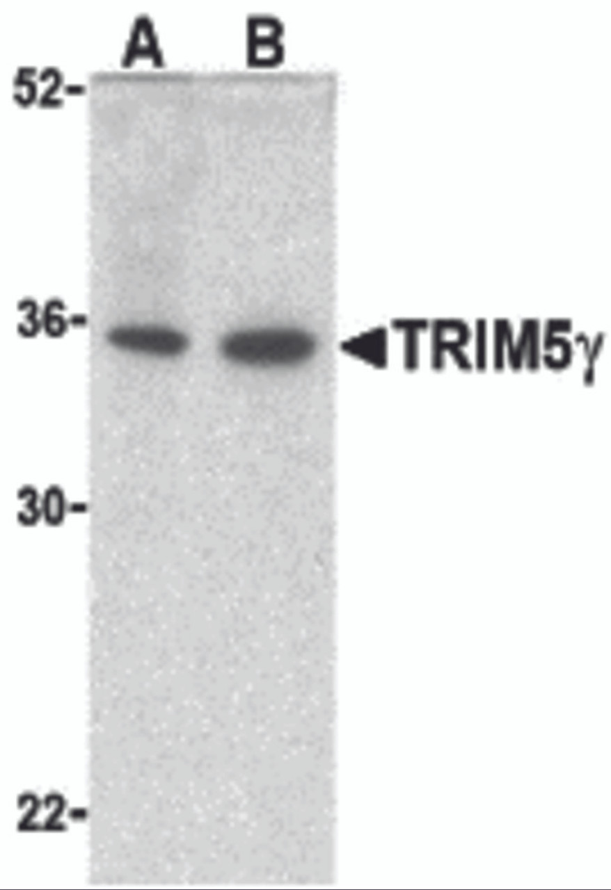 Western blot analysis of TRIM5 gamma expression in human bladder (A) and colon (B) cell lysate with TRIM5 gamma antibody at 2 &#956;g/ml.