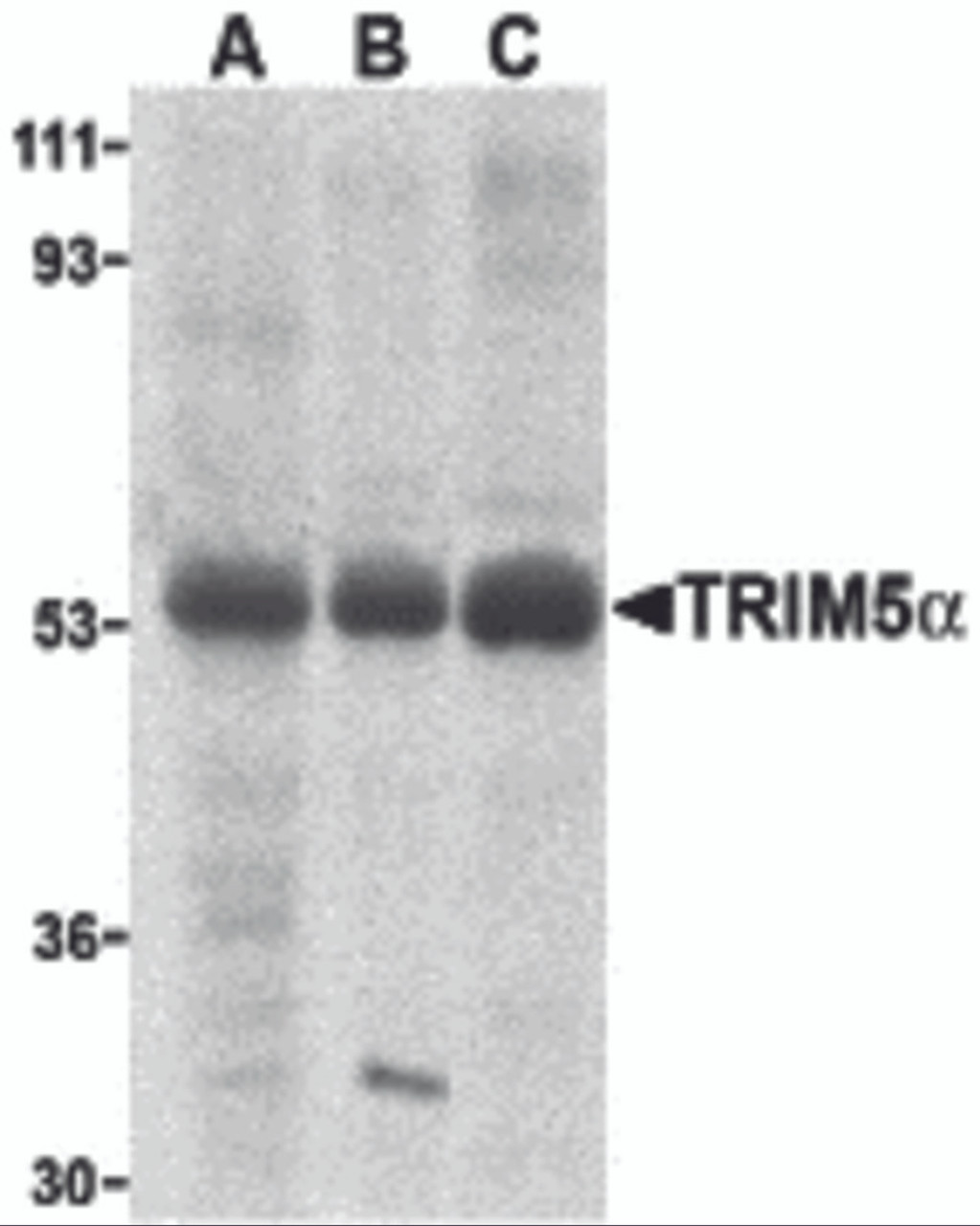 Western blot analysis of TRIM5 alpha expression in human stomach (A) , thymus (B) , and uterus (C) cell lysate with TRIM5 alpha antibody at 2 &#956;g/ml.