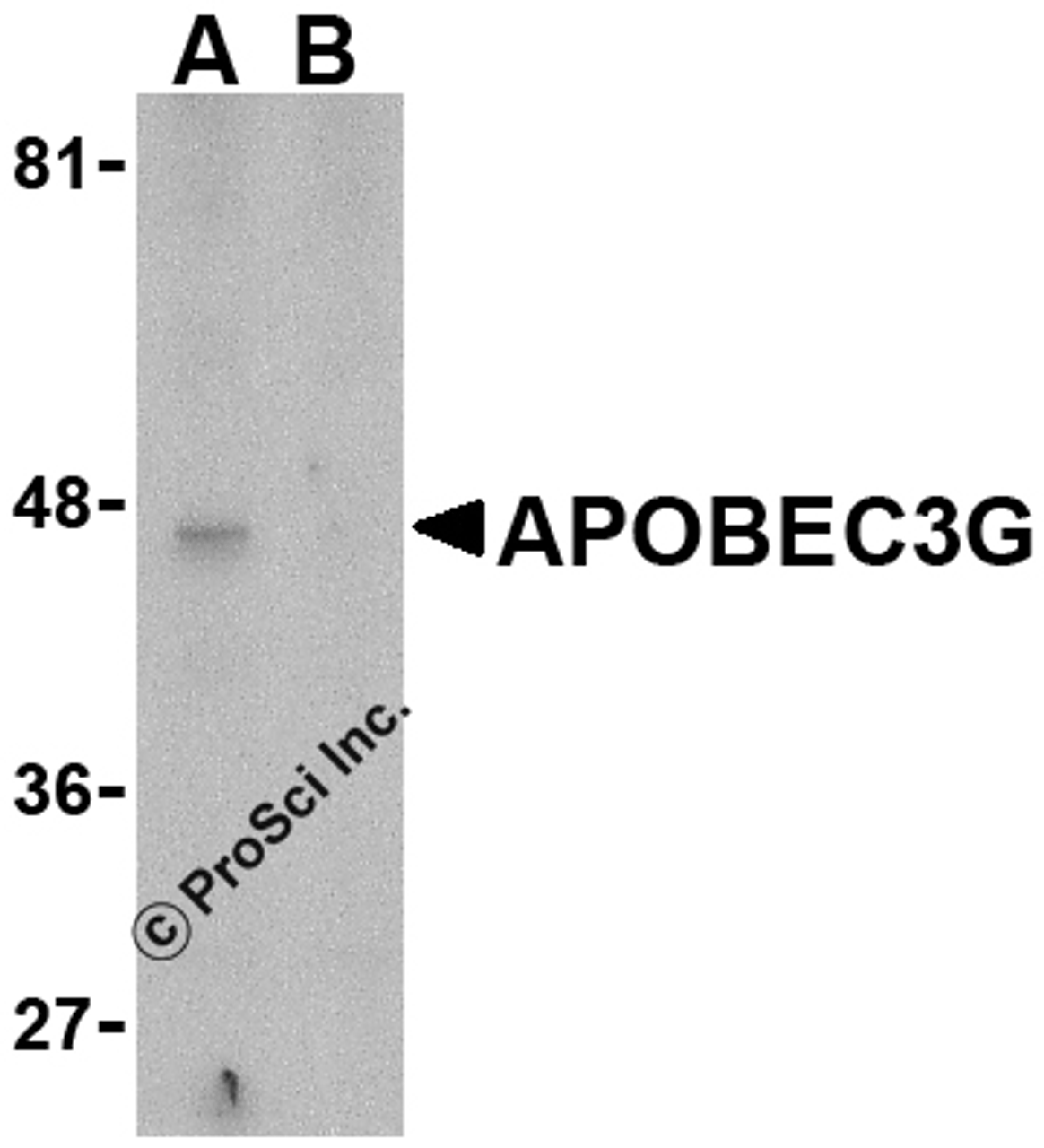 Western blot analysis of APOBEC3G expression in Caco-2 cell lysate in the (A) , absence and (B) presence of blocking peptide with APOBEC3G antibody at 5 &#956;g/mL.