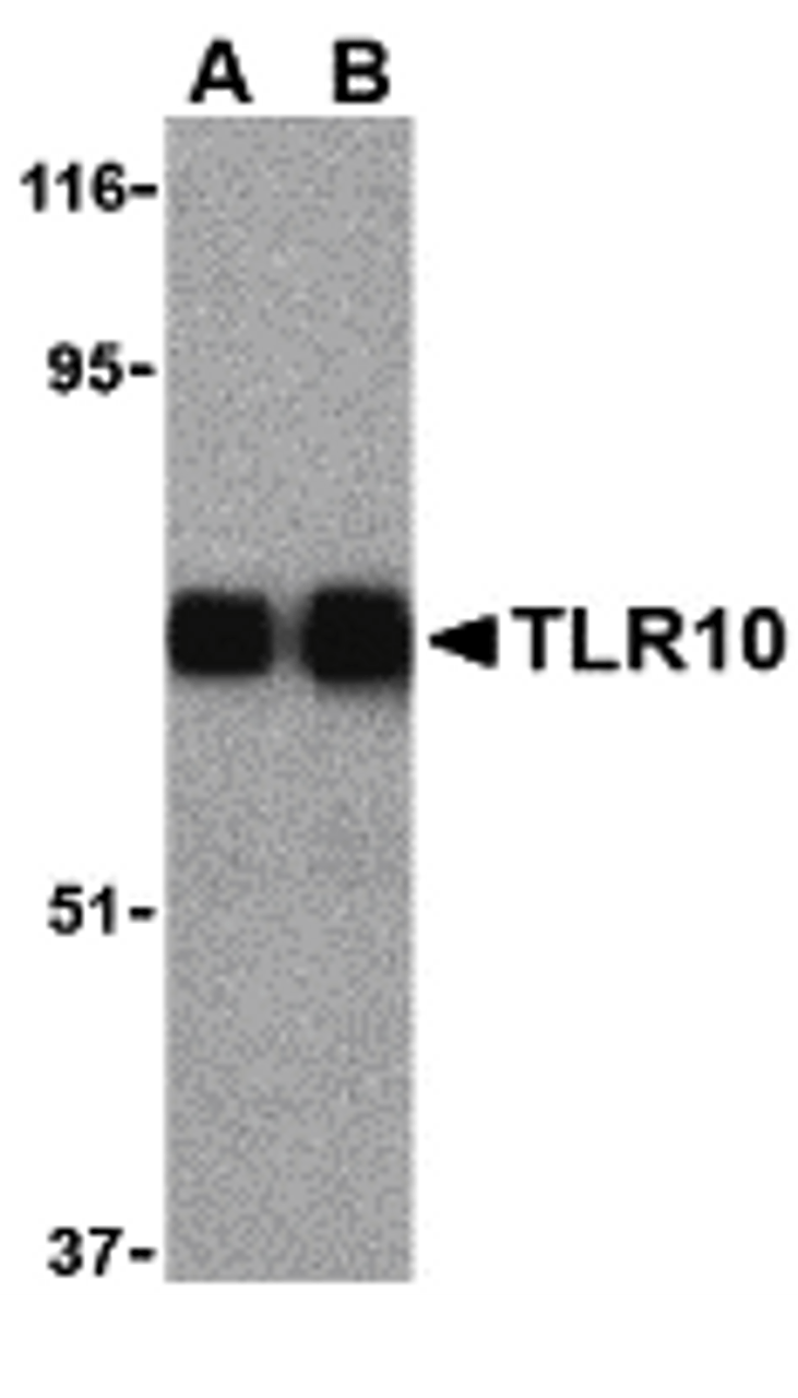 Western blot analysis of TLR10 in human lymph node cell lysates with TLR10 antibody (IN) at (A) 0.5 and (B) 1 &#956;g/mL.