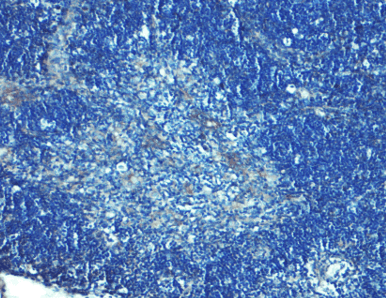 Immunohistochemistry of TLR8 in mouse thymus tissue with TLR8 Antibody at 5 ug/mL.
