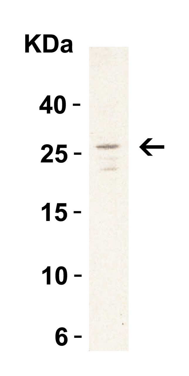 Figure 2 Western Blot Validation in Daudi Cell Lysate
Loading: 15 ug of lysates per lane.
Antibodies: MD-2, 3289 (1 ug/mL) , 1h incubation at RT in 5% NFDM/TBST.
Secondary: Goat anti-rabbit IgG HRP conjugate at 1:10000 dilution.