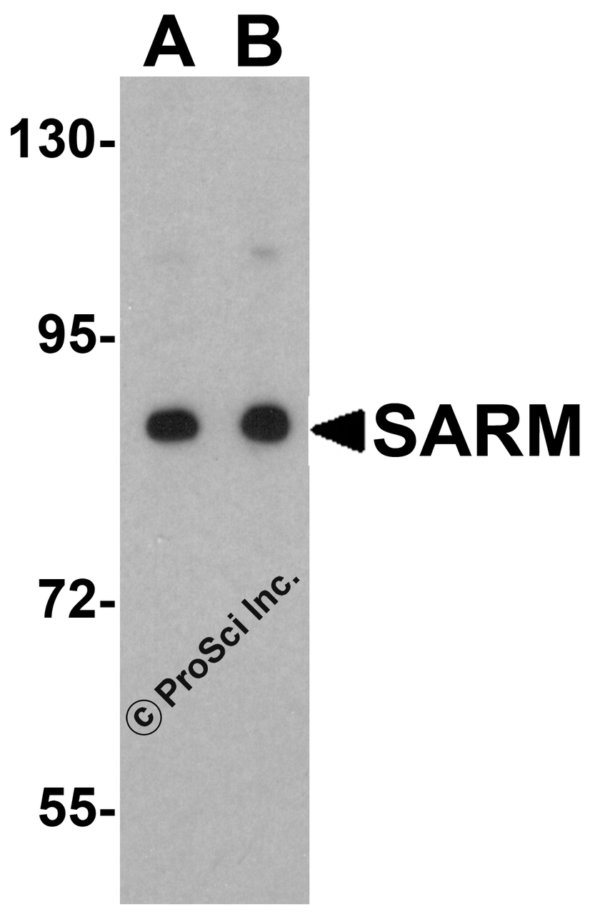 Western blot analysis of SARM in Daudi cell lysate with SARM antibody at (A) 0.5 and (B) 1 &#956;g/mL.