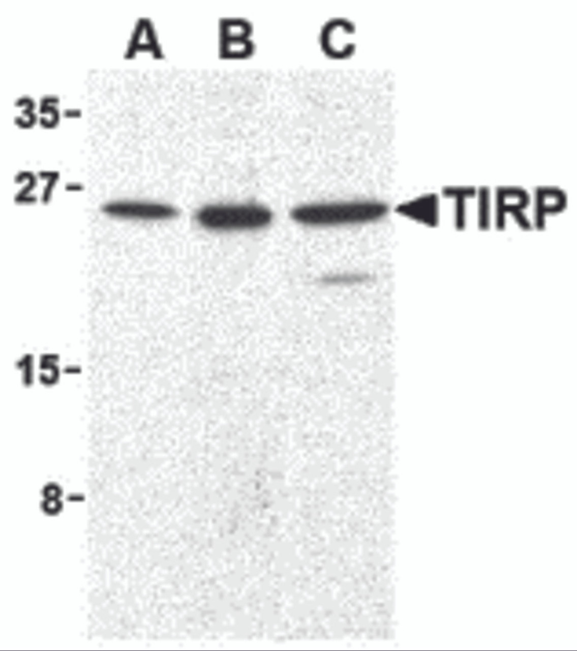 Western blot analysis of TIRP in human (A) , mouse (B) , and rat (C) kidney cell lysates with TIRP antibody (C2) at 1 &#956;g/mL.