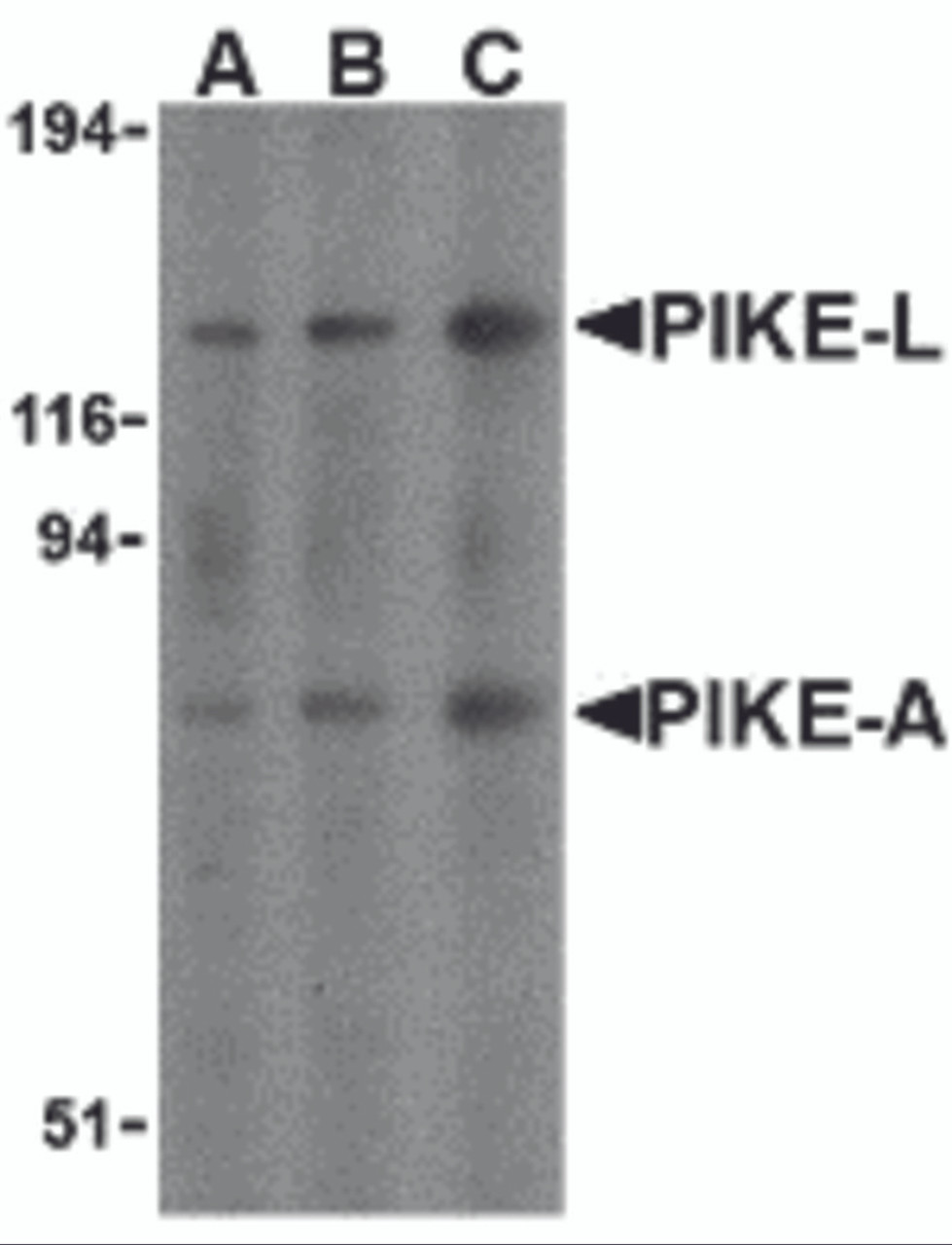 Western blot analysis of PIKE in mouse brain cell lysates with PIKE antibody at (A) 0.5, (B) 1, and (C) 2 &#956;g/mL.